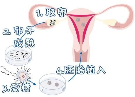 陈鎏主任